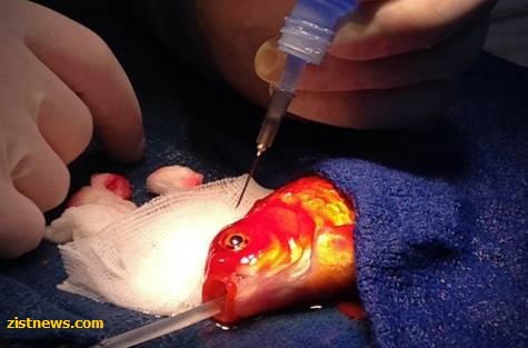 جراحی مغز متفاوت!