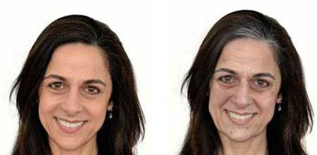 آنچه استرس بر سر صورت میآورد (+عکس) آنچه استرس بر سر صورت میآورد (+عکس)