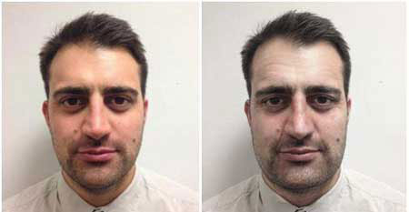 آنچه استرس بر سر صورت میآورد (+عکس) آنچه استرس بر سر صورت میآورد (+عکس)