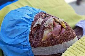 پدر سهیلا: اسیدپاش را بدهند خودم مجازات کنم