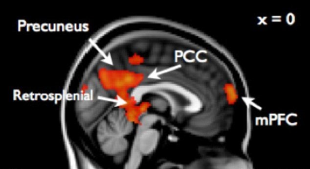 در مغز نوجوانان سرکش واقعا چه می‌گذرد؟