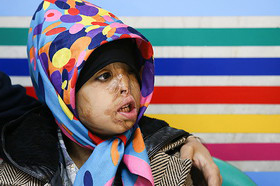 حال و روز کوچکترین قربانی اسید‌پاشی خوب نیست