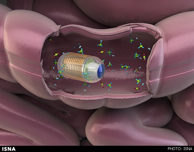 پیشگیری از سرطان گوارش با آشکارساز گاز روده