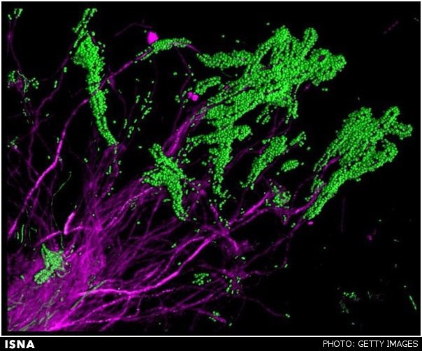 تصاویر رنگارنگ از میکروب‌های دندان