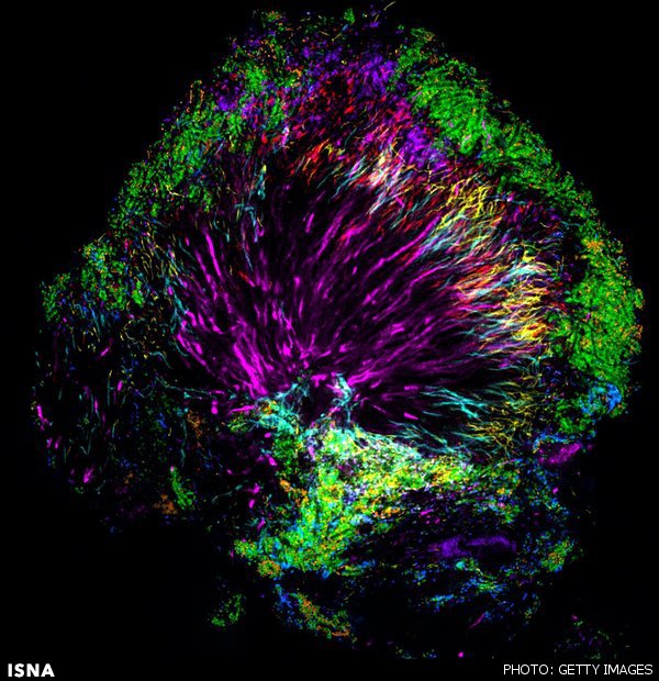 تصاویر رنگارنگ از میکروب‌های دندان