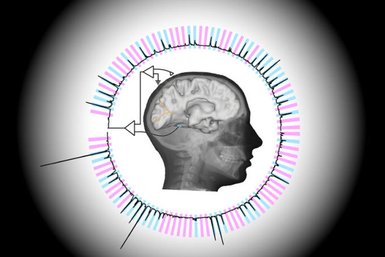 تکنیکی جدید برای خواندن ذهن انسان با سرعت بالا تکنیکی جدید برای خواندن ذهن انسان با سرعت بالا