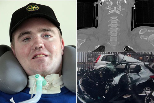 بازگشت به زندگی مردی که سرش قطع شد!