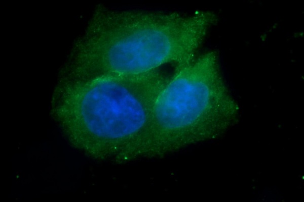کشف پروتیین عامل رشد سلول های سرطانی کشف پروتیین عامل رشد سلول های سرطانی