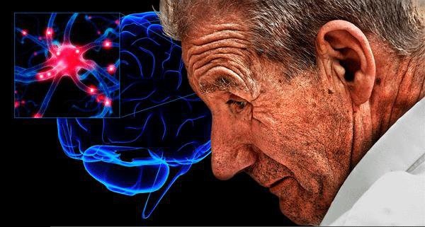 احتمال شروع پارکینسون از رودهها احتمال شروع پارکینسون از رودهها