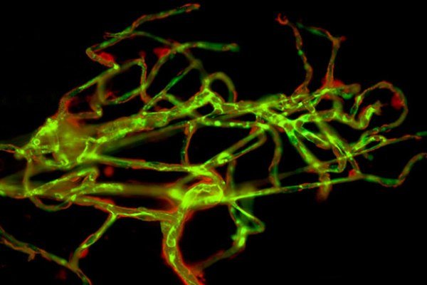 پروتئین عامل سکته مغزی کشف شد پروتئین عامل سکته مغزی کشف شد