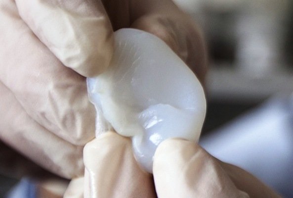 تولید گوش مصنوعی با چاپ ۳ بعدی