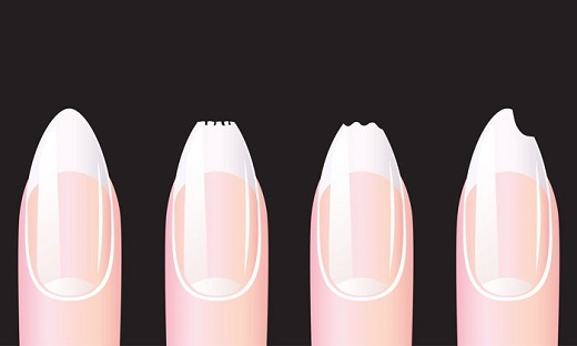 10 نشانه دریافت ناکافی مواد مغذی 10 نشانه دریافت ناکافی مواد مغذی