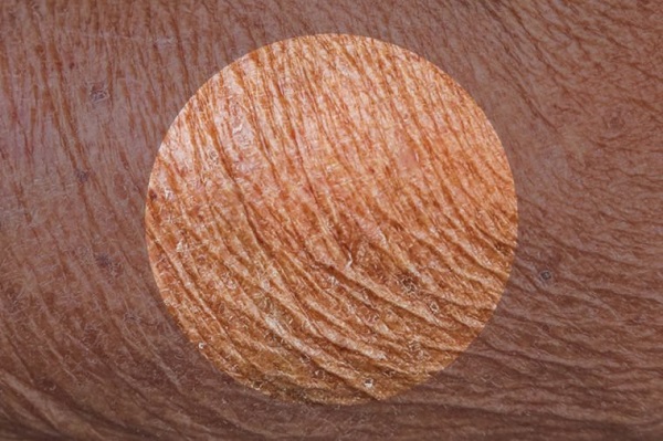 رابطه استرس و شرایط پوست