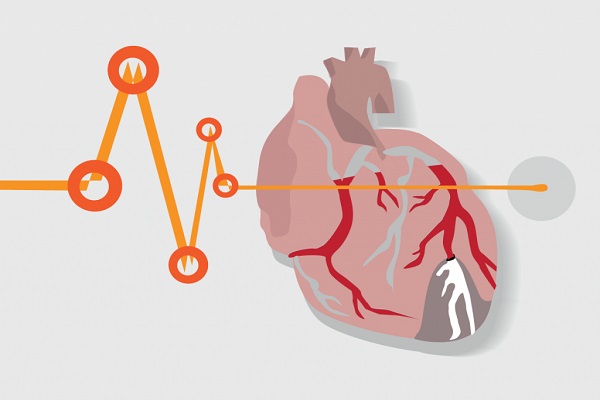 موارد شگفت انگیزی که به سلامت قلب آسیب می زنند