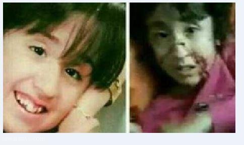 آرزوی دختری که با قمه پدرش شکنجه شد: می خواهم پیانیست شوم/ می خواهم زنده بمانم