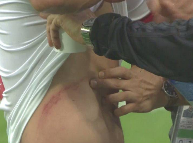 یک زخم و راز یک تفاوت یک زخم و راز یک تفاوت