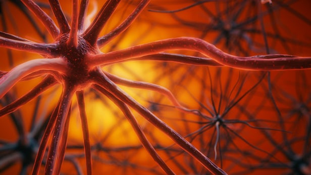 چرا پلاکهای آلزایمر همواره به زوال عقل منجر نمیشوند؟ چرا پلاکهای آلزایمر همواره به زوال عقل منجر نمیشوند؟