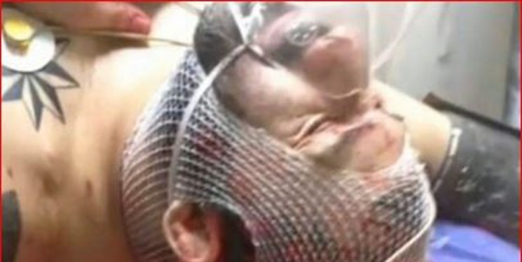 دستگیری یکی از عاملان ضرب و جرح &laquo;هانی کُرده&raquo;