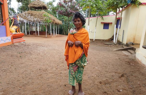 زنی که دارای رکورد بیشترین انگشت دست و پا است! (+عکس) رکورد بیشترین انگشت دست و پا