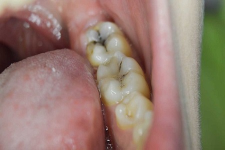 کلینیک سرطان عصر ایران/ بروزرسانی اردیبهشت ۹۸