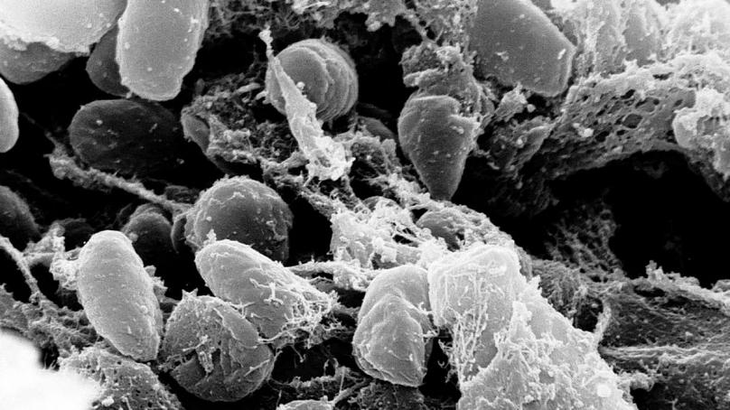 از طاعون سیاه تا کرونا؛ شیوع بیماریهای همهگیر در طول تاریخ از طاعون سیاه تا کرونا