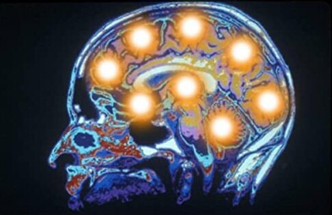 مثبت&zwnj;اندیشی با گوش&zwnj;دادن به موسیقی کیهانی 