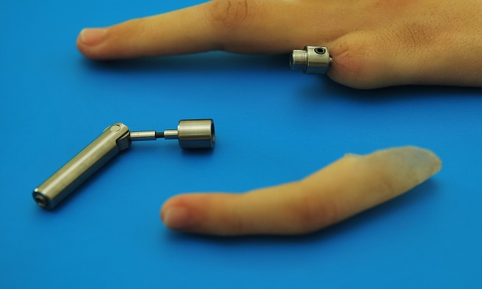 پروتزهایی که زندگی انسانها را تغییر میدهند پروتزهایی که زندگی انسانها را تغییر میدهند