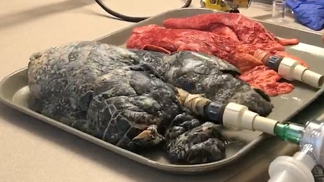 تاثیر سیگار کشیدن بر ریه&zwnj;ها به روایت تصویر