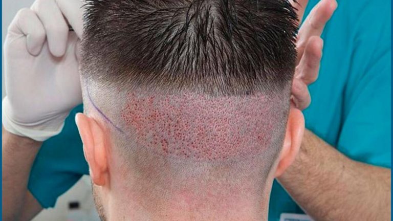 روزنامه شرق: گردشگران از خارج برای جراحی زیبایی به مشهد می آیند/ کار دلال ها سکه است