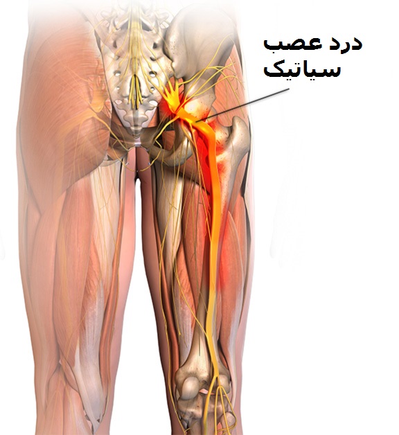 از انواع درد پا تا علل هر یک از آنها