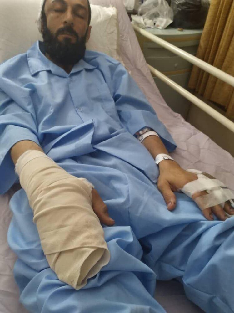 کتک زدن ۲ امام جماعت با لوله آهنی در قم  (+عکس)