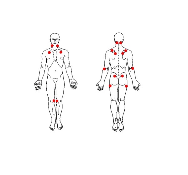 فیبرومیالژی؛ دردی مزمن که شما را رها نمی‌ کند!
