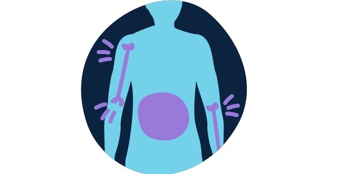 سرطان خون و همه چیز درباره نشانه های آن