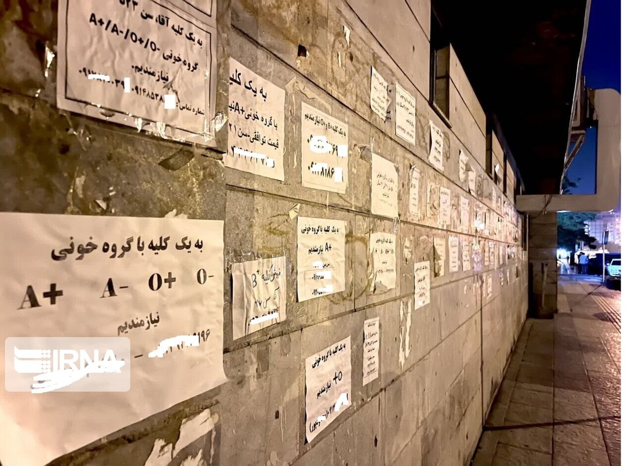 عضو بدن شما را خریداریم! / فروش دلاری کلیه با سفر ایرانی ها به ترکیه و عراق عضو بدن شما را خریداریم! / فروش دلاری کلیه با سفر ایرانی ها به ترکیه و عراق